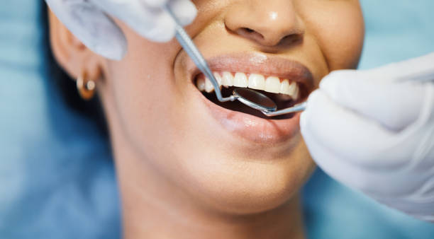 Best Knocked-Out Tooth (Avulsed Tooth) Treatment in Weiser, ID